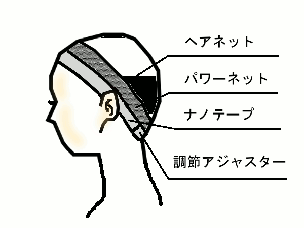 リフトアップネット